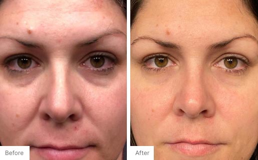 8 - Before and After Real Results of Age IQ Day Cream on a woman's face